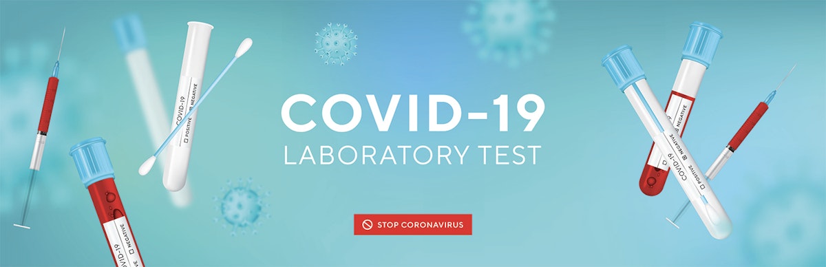 ¡Cuidado! 26+  Listas de Test Covid Pcr? The tests are fast and highly accurate.